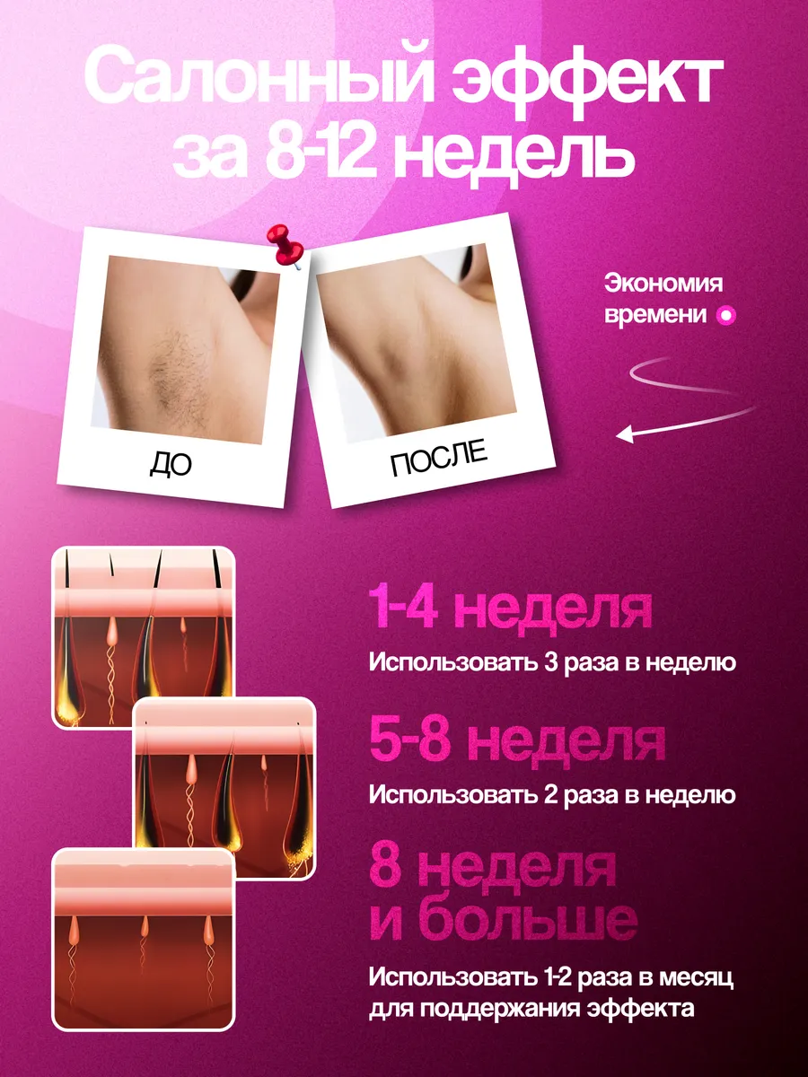 Характеристики фотоэпилятора